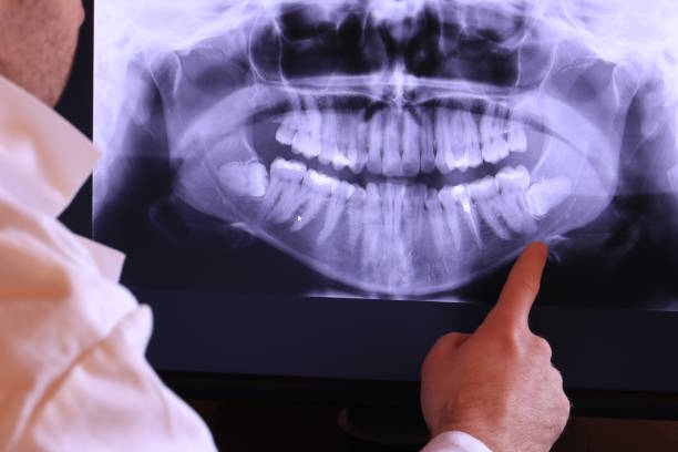 Best Broken or Cracked Tooth Emergency Dentist in Apple Mountain Lake, VA