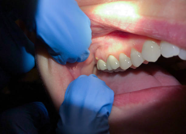 Best Emergency Cosmetic Dentistry in Apple Mountain Lake, VA