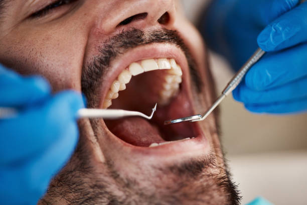 Best Emergency Dentist for Knocked-Out Tooth in Apple Mountain Lake, VA